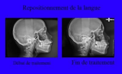 T l  radio 1 et 2  jjd83f - Eugenol