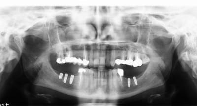 Ted chris2 z58qws - Eugenol