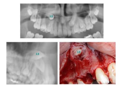 Test canine n 3 ndgkpw - Eugenol