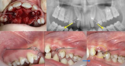 Test canines n 2 yymtd7 - Eugenol