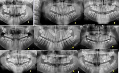 Test canines pjhat8 - Eugenol