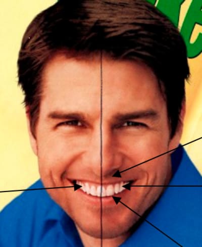 Tom cruise smile bay dental and orthodontics sydney australia igfbgs - Eugenol