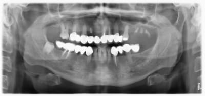 Turquie tvtj68 - Eugenol