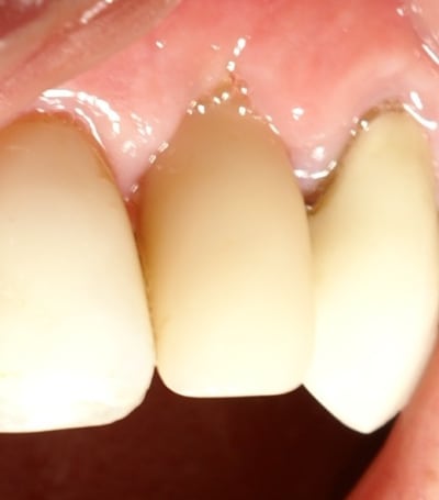 Un mois z2lfka - Eugenol