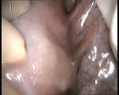 Unknown v 2013 07 18 17 06 10 3 jf80vy - Eugenol