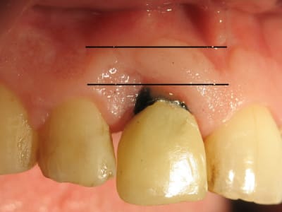 Untitled 1 l1ip2d - Eugenol