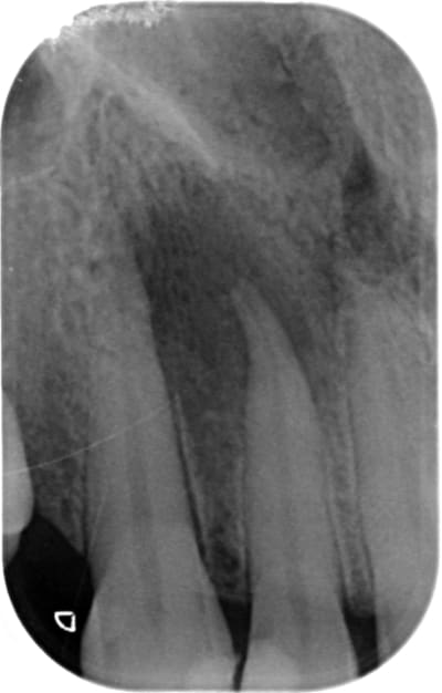 Urgences gardes 19770128 x 20150526 151626 xsnquc5kmmh 3 otkwaw - Eugenol