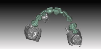 Vueh kdbl3s - Eugenol