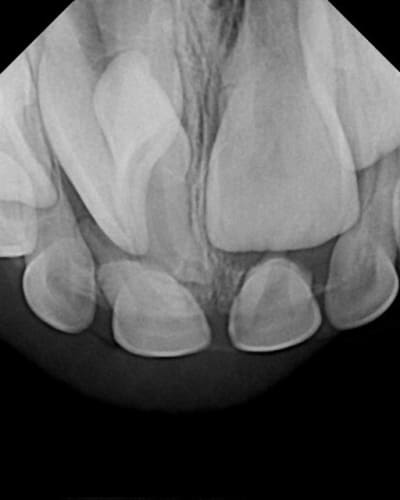 X19123 fejvcu - Eugenol