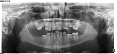 X29927 kkrw8d - Eugenol