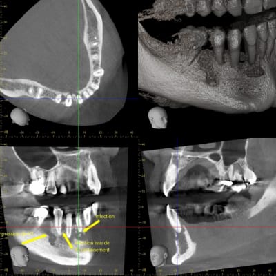 Xyzview 20140703 133108 gogz3z - Eugenol
