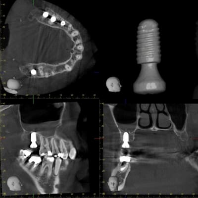 Xyzview 2015125234 nyhseu - Eugenol