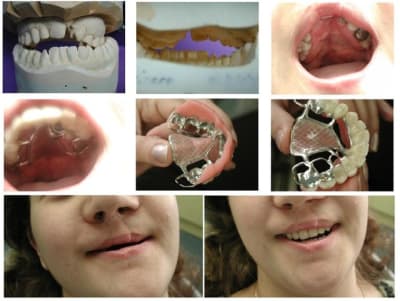 Z el mddqli - Eugenol