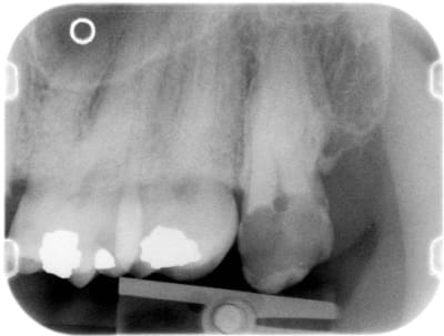  étaitbien fgt6zb - Eugenol