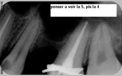  était prévu rv8mtw - Eugenol