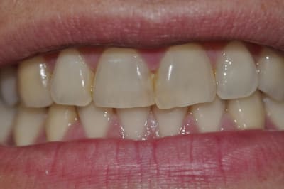  dsc0005 hjoyiq - Eugenol
