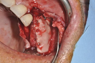  dsc1151 hreajx - Eugenol