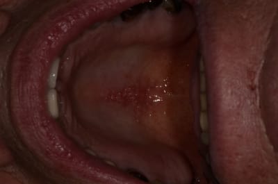  dsc1687 ivusnl - Eugenol