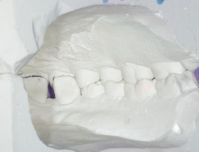  igp8419 kzp8up - Eugenol