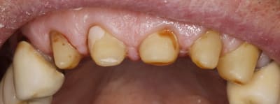  mg 0959 wglqht - Eugenol