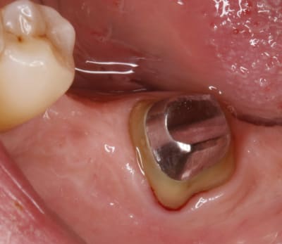  mg 1491 usrz35 - Eugenol