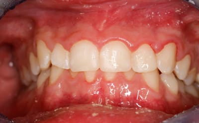  mg 1746 z4my4e - Eugenol