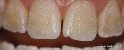  mg 1773 l4zctg - Eugenol