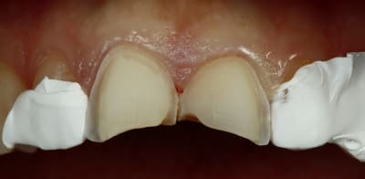  mg 3619 yczg6u - Eugenol