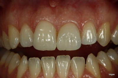 mg 3667 rlo8i7 - Eugenol