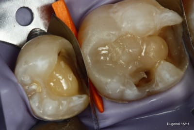  mg 5044 001 sycxql - Eugenol