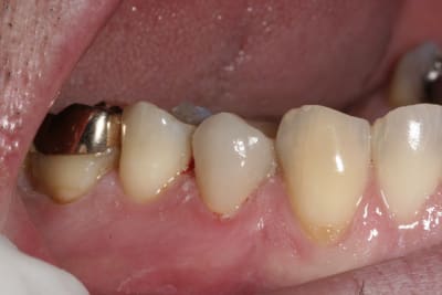  mg 7359 u1bpvu - Eugenol
