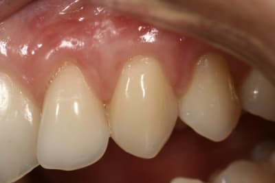  mg 7582 fxvixc - Eugenol