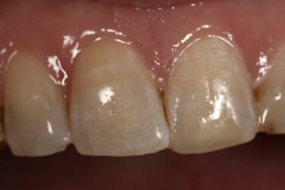  mg 8154 dqpcjg - Eugenol