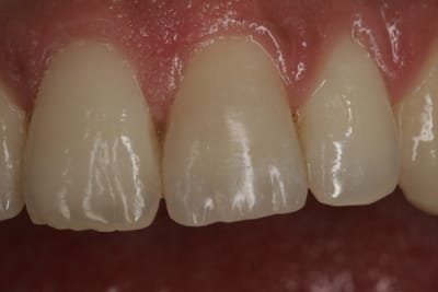  mg 8275 gjo0xf - Eugenol