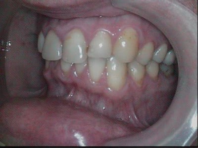  at 00 58 48 296  025 img s  vk80ge - Eugenol