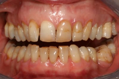  carteurs ghd0kd - Eugenol