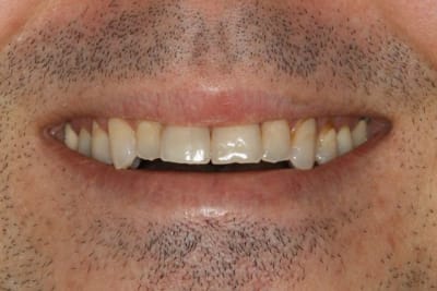  tat initial sourire xvebip - Eugenol