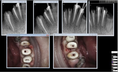 Ab90ka072yua2zqtvwj2dncrm4sj - Eugenol