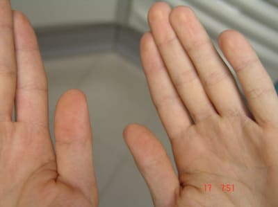 Ac2 zlkwbw - Eugenol