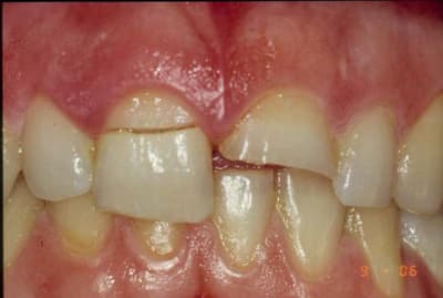 Amant1 sfaipj - Eugenol