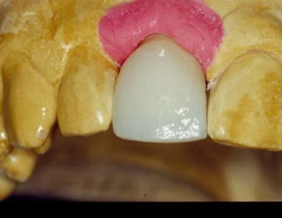 Amant7 lxlyn6 - Eugenol