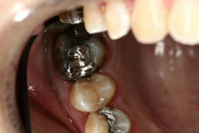 Amaris3 hi5tb4 - Eugenol