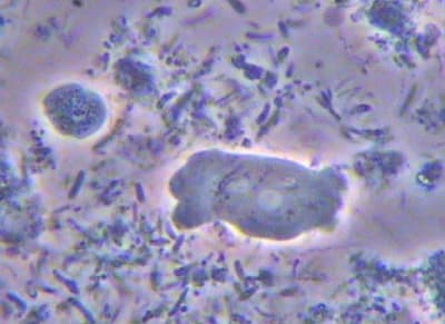 Amibe icpzis - Eugenol