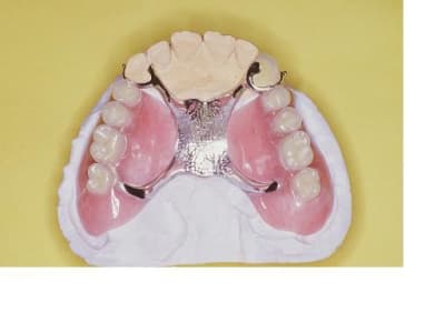Amorti 2 buant4 - Eugenol