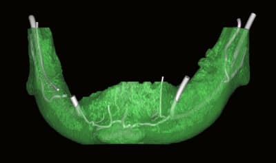 Anat3 xa5eez - Eugenol