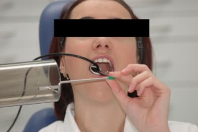 Angulateur pbtonp - Eugenol