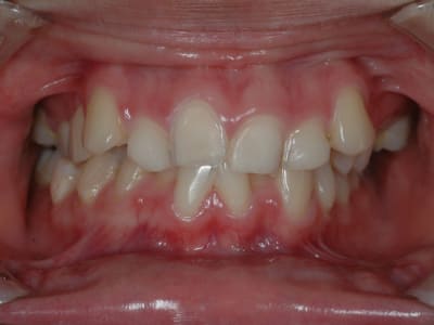 Anne nonima2 y4ldaw - Eugenol