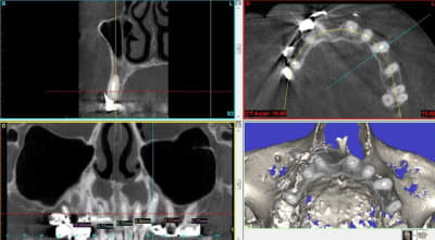 Aper u g n ral klb1id - Eugenol