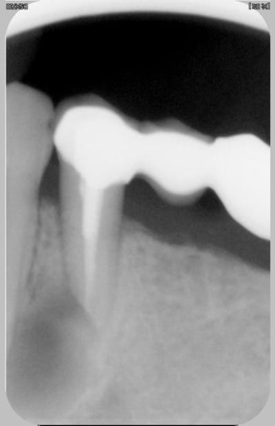 Après res ynzmp0 - Eugenol