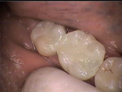 Après sc5jl0 - Eugenol